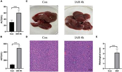 Gut Microbiota Was Involved in the Process of Liver Injury During Intra-Abdominal Hypertension